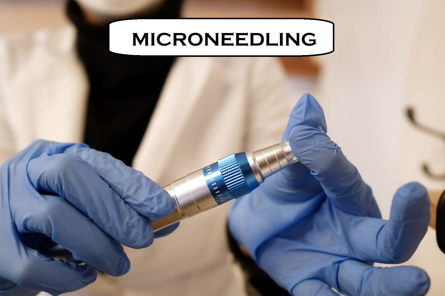 microneedling